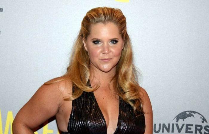 Amy Schumer suffered from Cushing’s syndrome