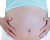 Pregnancy: new method to identify women at risk of preeclampsia