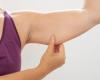 Too much fat in the arms, bad for women’s bones?