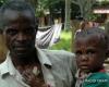 Monkeypox declared in North Kivu