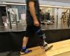 Brain-controlled prosthetic legs soon?