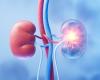 a regenerated kidney for the first time