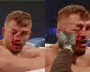 This fighter's face literally collapses