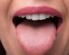 Brushing your tongue, a good oral habit?