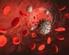 infection increases risk of blood lipid abnormalities