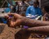 Mpox: slight slowdown in contamination in Africa