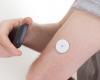 Diabetes: how continuous glucose measurement has changed patients’ lives