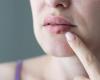 the cold sore virus can find its way to the brain