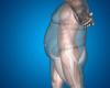 Anti-obesity: competition is increasing around new treatments