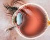 Transplanting stem cells to treat blindness