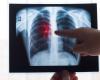 We could screen for coronary heart disease at the same time as lung cancer