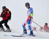 broken teeth for skier Clément Noël in Val d’Isère