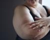 Italy: the government will devote several million euros to fight obesity