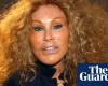 Jocelyne Wildenstein, socialite known for extreme cat-like plastic surgery, dies at 84 | Paris