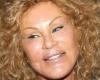 Jocelyne Wildenstein, Socialite and Tabloid ‘Catwoman,’ Dies at 79