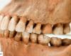 Neanderthal heritage could be hiding in your teeth