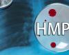 Is HMPV Fatal? Understanding The Health Complications Of HMPV