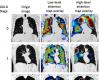 Diagnosis of COPD by one-shot CT aided by a neural network