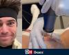 Wout van Aert’s impressive scars: here is the state of his knee four months after his big fall at the Vuelta (VIDEO)