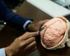 A brain implant to overcome depression, anxiety and even epilepsy will be tested